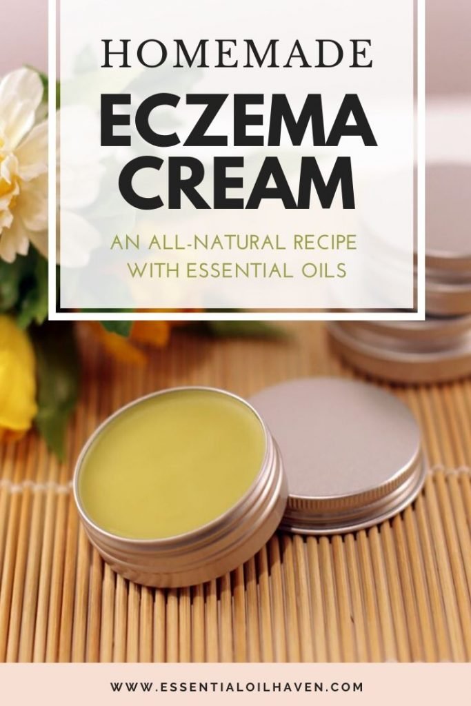 eczema calendula essentialoilhaven itchy