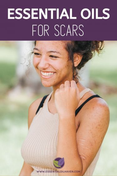 best essential oils for scars