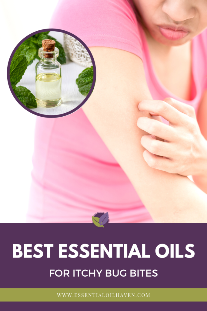 How to Treat Bug Bites with Essential Oils – 3 Simple Recipes