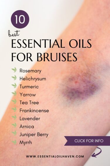 best essential oils for bruises