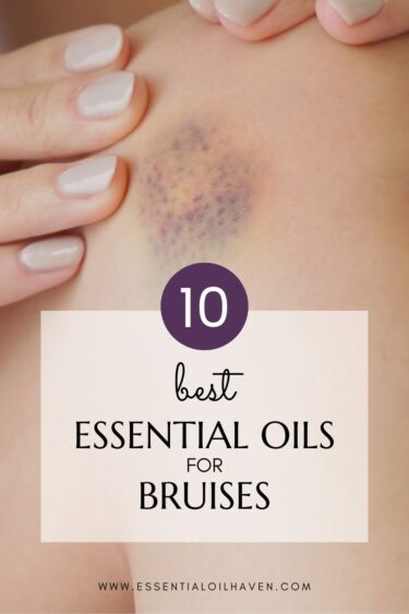 best essential oils for bruising