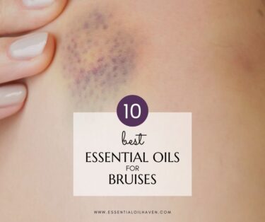 best essential oils for bruises