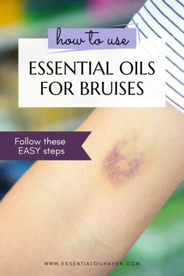 what essential oils work for bruises