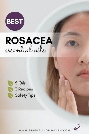 rosacea essential oils