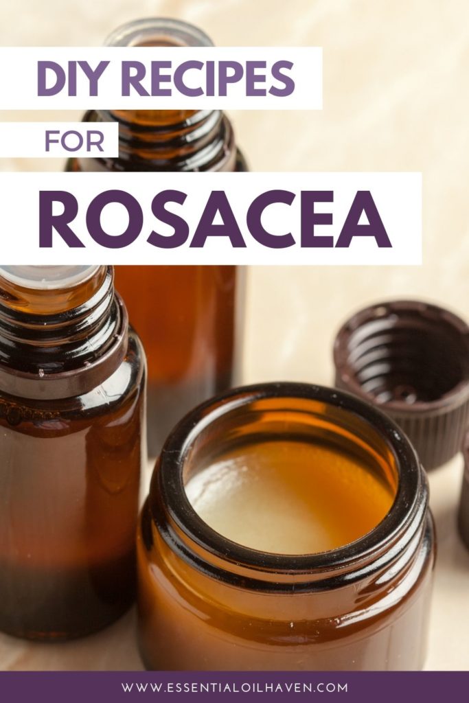 5 Best Essential Oils For Rosacea (PLUS Recipes That Use Them)