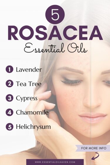 5 best essential oils for rosacea skin