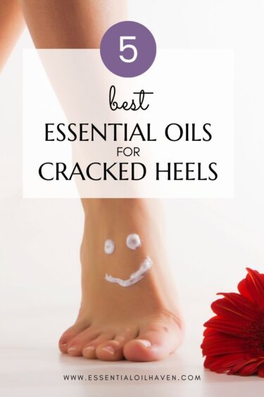 how to use essential oils for cracked heels