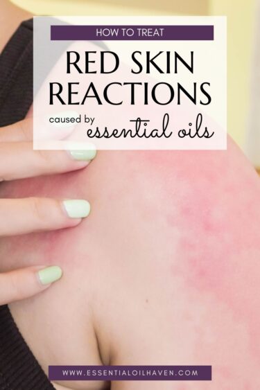 red skin reactions essential oils