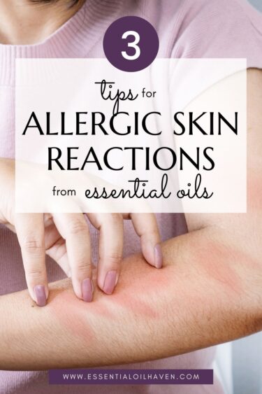 allegic skin reactions due to essential oils use