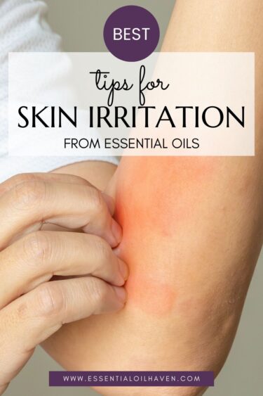 tips for skin irritation because of essential oils