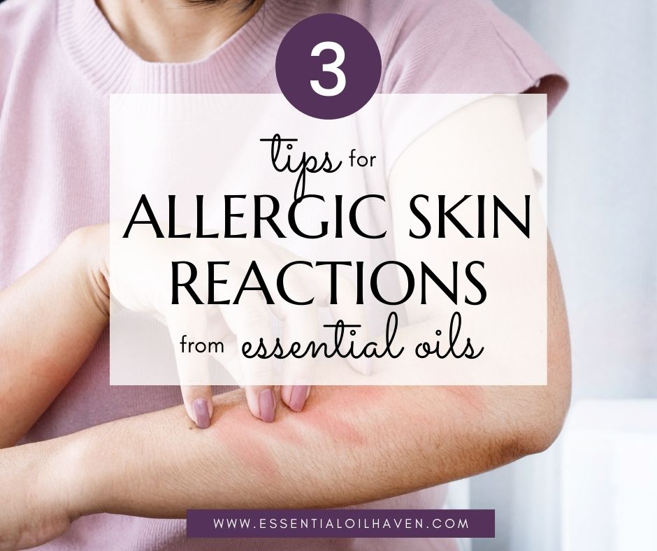 how to treat allergic reaction to essential oils