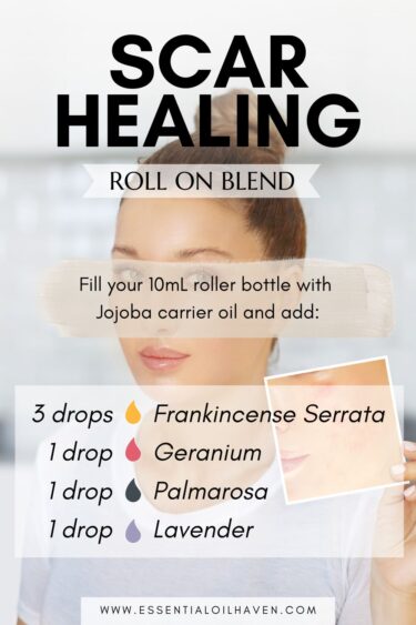 essential oil blend DIY roller bottle recipe for scars